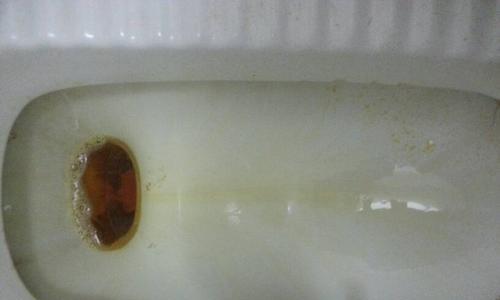 尿液变绿色的常见原因及健康提示(图2)