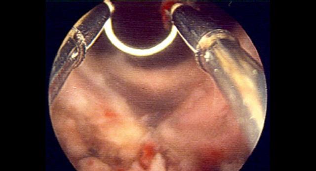 尿液变绿色的常见原因及健康提示(图3)