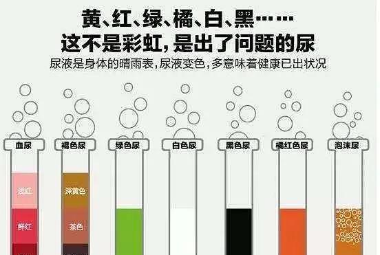 尿液变绿色的常见原因及健康提示