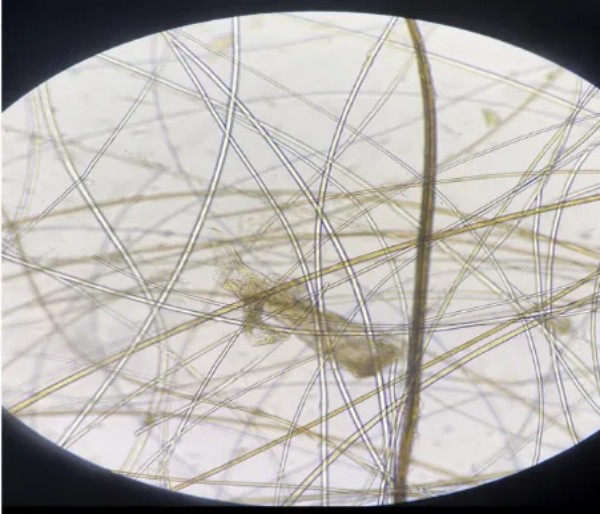 犬跳蚤过敏性皮炎病例分析与综合治疗方案(图6)