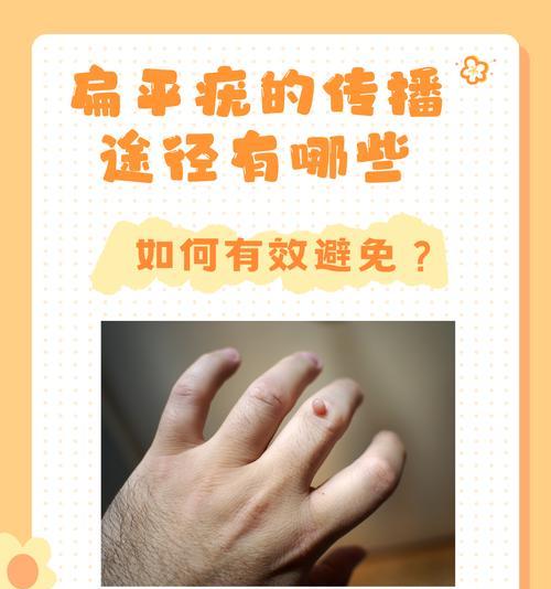 人类传染病传播与预防措施全解析(图2)