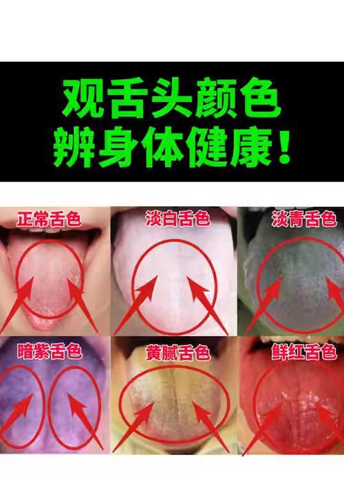 舌苔颜色与健康关系解析(图3)
