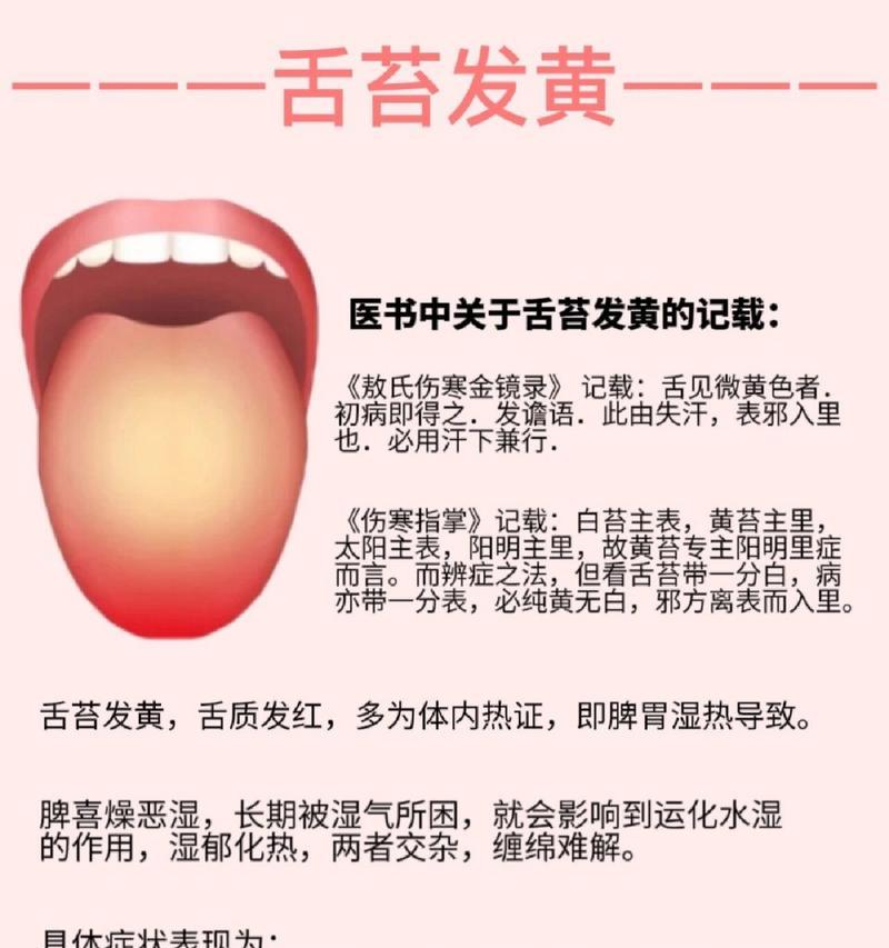 舌苔颜色与健康关系解析