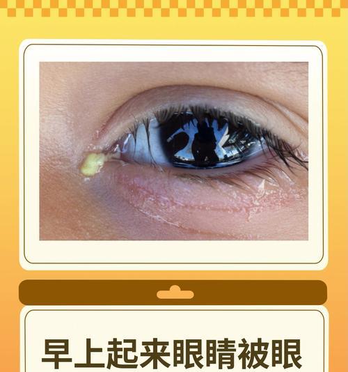 狗狗眼屎多原因及治疗方案详解(图2)