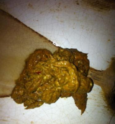 拉大便不成形的原因及处理方法｜预防改善全指南(图3)