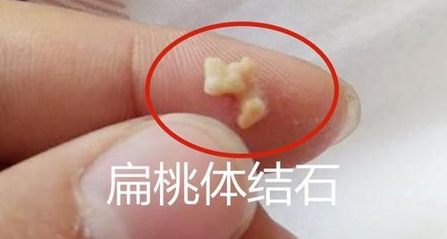 身上气味臭可能是什么病？常见病因与应对方法全解析(图1)