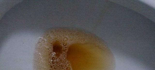 身上气味臭可能是什么病？常见病因与应对方法全解析(图2)