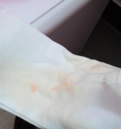 尿中出现血迹的原因及应对方法｜健康指南(图3)