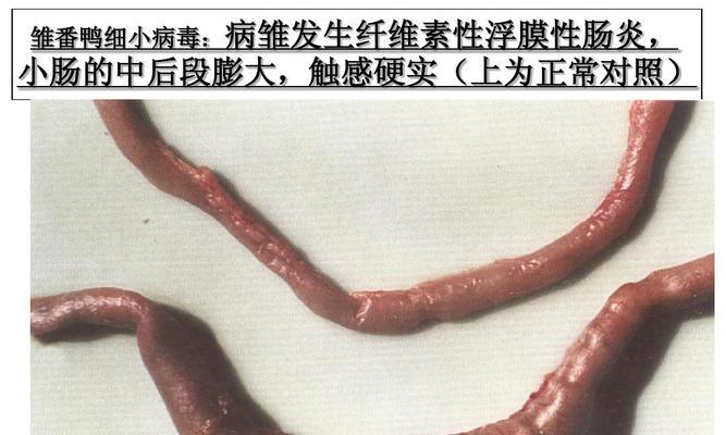 慢性细小症状全面解析（了解慢性细小症状及其治疗关键）(图3)