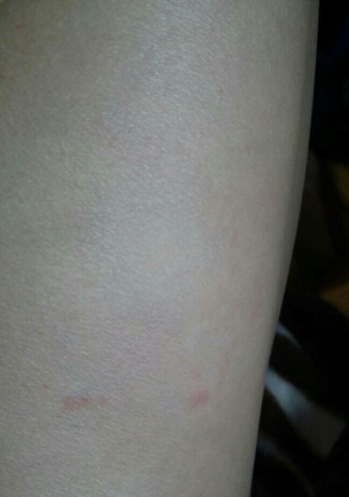 为什么狗狗要咬自己的腿？（探究狗狗咬腿行为的原因和解决方法）(图1)