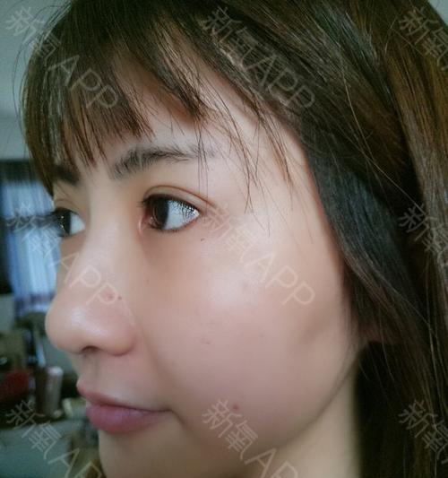 怀孕64天的症状及应对措施（了解怀孕初期的身体变化，做好孕期