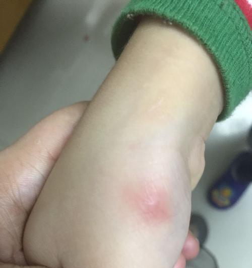 猫猫弓虫病预防与治疗全攻略｜守护爱宠健康