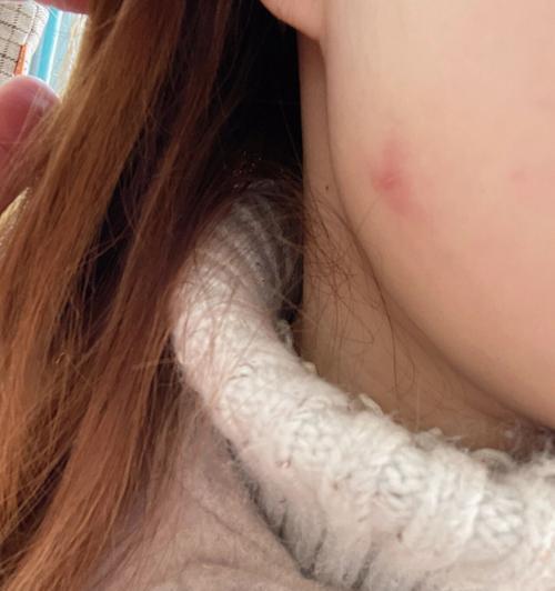 猫咪身上的细菌全攻略｜保护你和宠物的健康(图1)