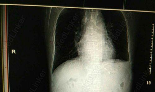 狗狗黑色便便原因全攻略｜如何判断与处理(图3)