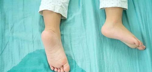 拉屎和尿尿的相似性与差异｜排泄机制全攻略(图2)