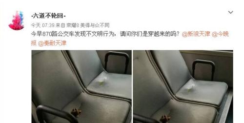 拉屎和尿尿的相似性与差异｜排泄机制全攻略(图3)