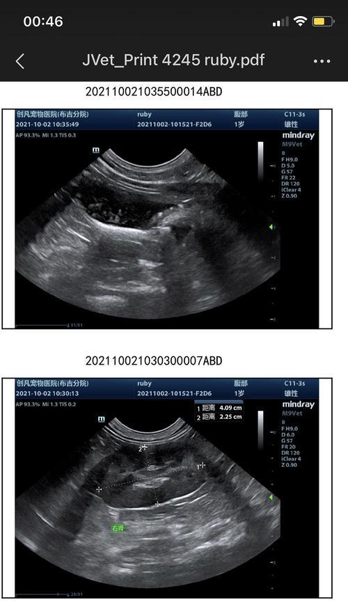 膀胱结晶形成原因与治疗全攻略｜轻松应对泌尿系统不适
