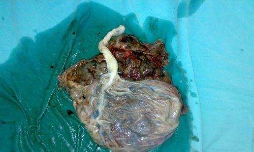 狗的胎盘结构与功能全攻略｜深入了解生命之源(图3)