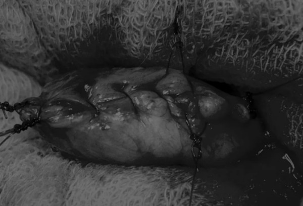 膀胱切开术实用指南｜宠物手术核心技巧全解析(图7)