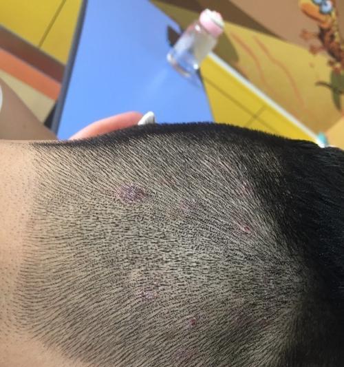 狗狗头皮屑成因及解决方法|实用指南(图3) 狗狗头皮屑成因及解决方法|实用指南(图3)