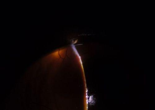 猫眼里的神秘黑黑之谜(解析猫眼中的黑色物质和其意义)(图1) 猫眼里的神秘黑黑之谜(解析猫眼中的黑色物质和其意义)(图1)