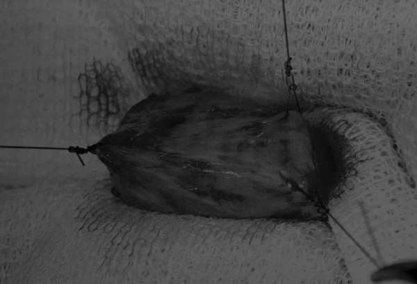 膀胱切开术全攻略(图2)