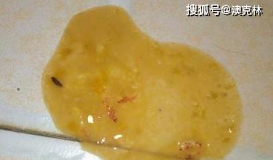 狗罐装病毒传播途径与常见症状｜防控意识全攻略(图3)