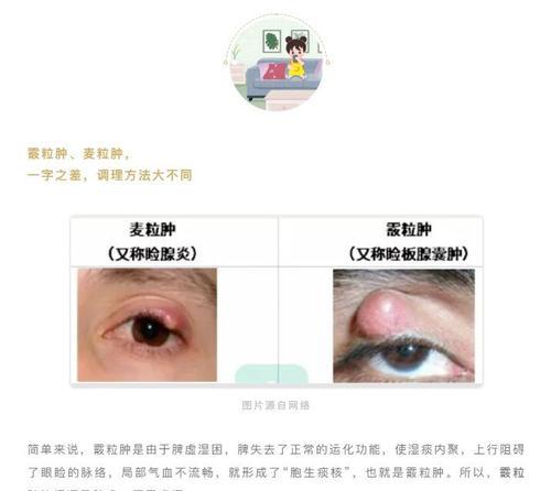 眼屎颜色揭秘｜健康问题早发现实用指南(图2)