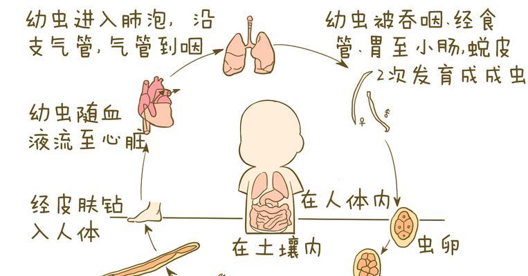肚子长虫常见症状与预防指南｜健康生活必备知识(图3)