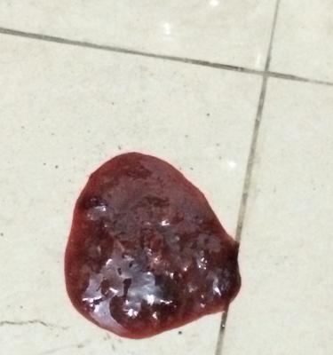 成年狗拉血的原因及处理方法（探究成年狗拉血的可能原因及有效的处理方法）(图3)