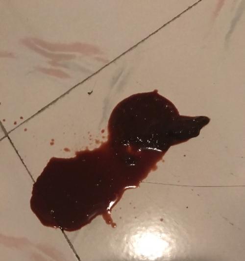 泰迪屎腥臭的原因解析（探究泰迪屎腥臭背后