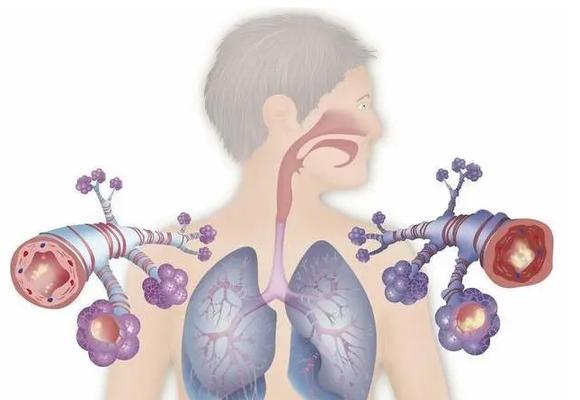 比熊气管炎——常见症状及治疗方法（了解比熊气管炎，保护我们的爱宠）(图2)