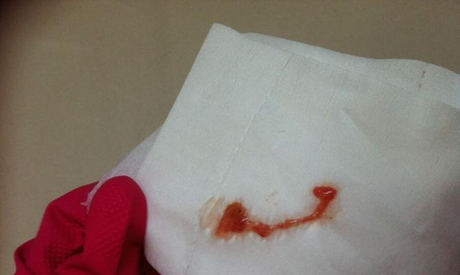 揭秘宠物泰迪的大便之谜（了解泰迪的消化系统，从大便说起）(图3)