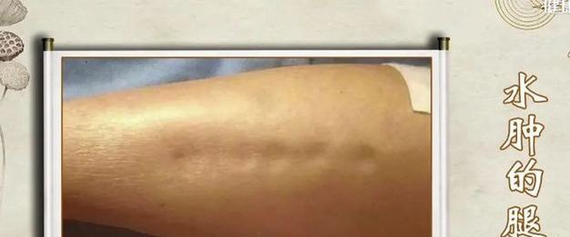 老年犬心衰的症状及其管理方法（老年犬心衰的常见症状及应对措施）(图2)