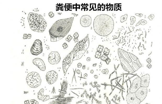 解析为什么狗大便多?(探究狗大便频繁的原因及相关健康问题)(图2) 解析为什么狗大便多?(探究狗大便频繁的原因及相关健康问题)(图2)