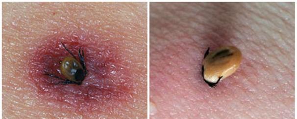 狗狗被蜱虫咬后的危害——保护你的宠物免受蜱虫侵害（了解狗狗被蜱虫咬后的风险，提前预防和处理）(图2)