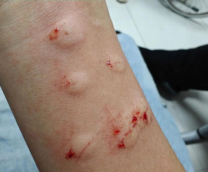 狗缺白蛋白的症状及预防措施（了解狗缺白蛋白症状的重要性，以及如何预防）(图3)