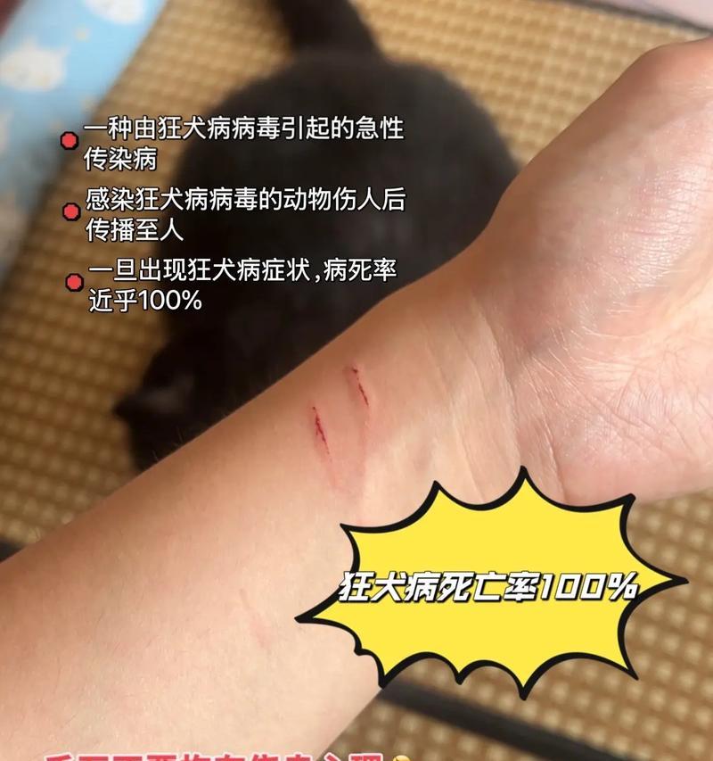 狗狗咬人攻击怎么办｜科学处理全攻略