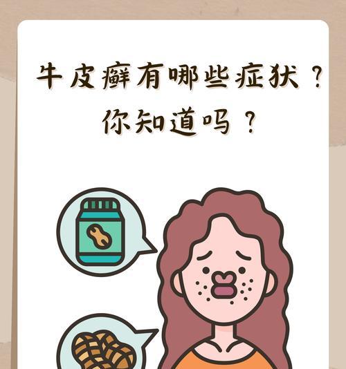 英斗皮肤病原因治疗方法全攻略(图3) 英斗皮肤病原因治疗方法全攻略(图3)