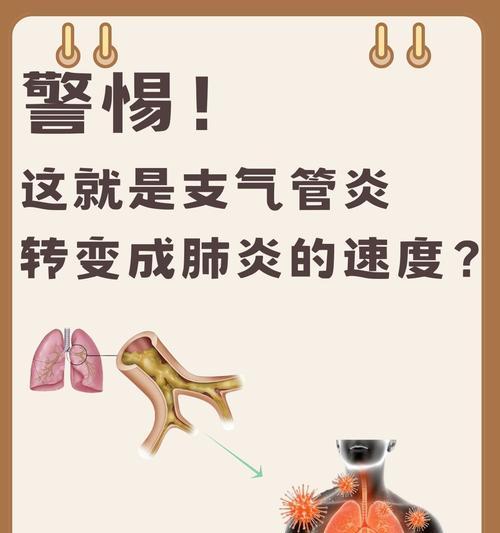 多菌康喷剂治疗周期与效果分析｜实用指南(图3)