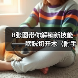 膀胱切开术全攻略(图4)